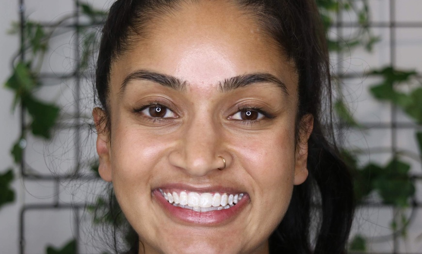 Image 2: Premium 60-Minute Teeth Whitening at Smile Labs Penrith