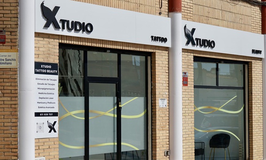 Image 5: Eliminación de manchas con Q-SWITCHED: 1 o 2 sesiones 