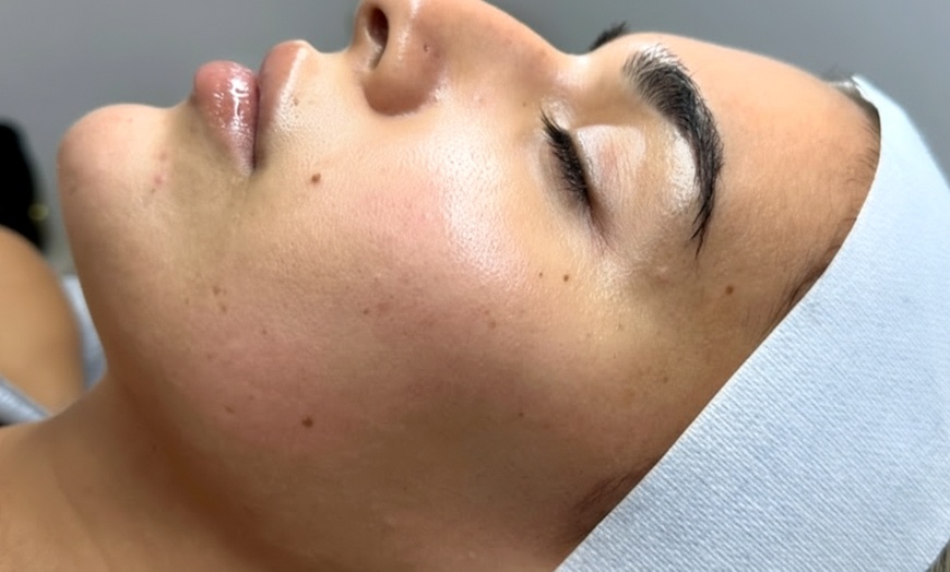 Image 1: Hydrabrasion Facial Treatment: 1 or 2 Sessions at JT Cosmetics (Up to 42% Off)