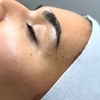 Image 1: Hydrabrasion Facial Treatment: 1 or 2 Sessions at JT Cosmetics (Up to 42% Off)