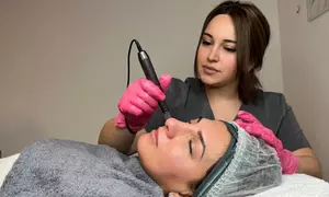 60 Min. Microneedling mit Serum nach Wahl, einlösbar für 1 Dame