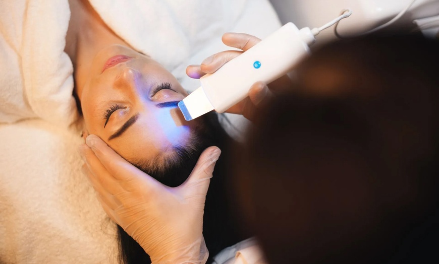 Image 4: 3 Sessions of Laser Hair Removal for a Small, Medium, or Large Area