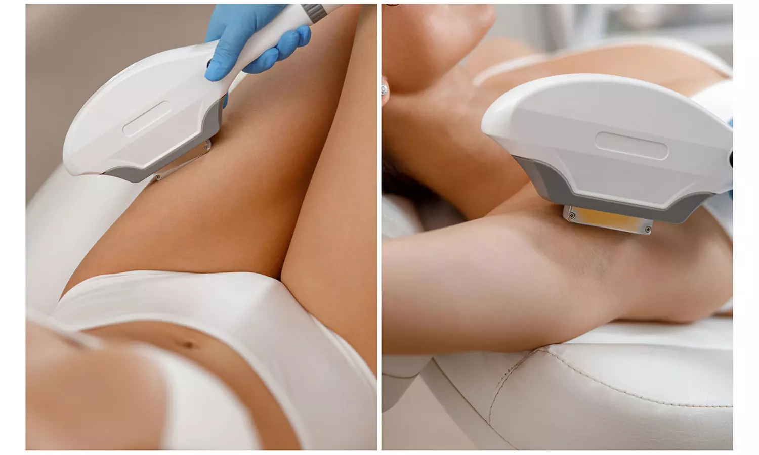 1, 3 o 5 sesiones de depilación IPL en zona a elegir entre pequeña, mediana o grande (hasta un 65% de descuento) - Image 3