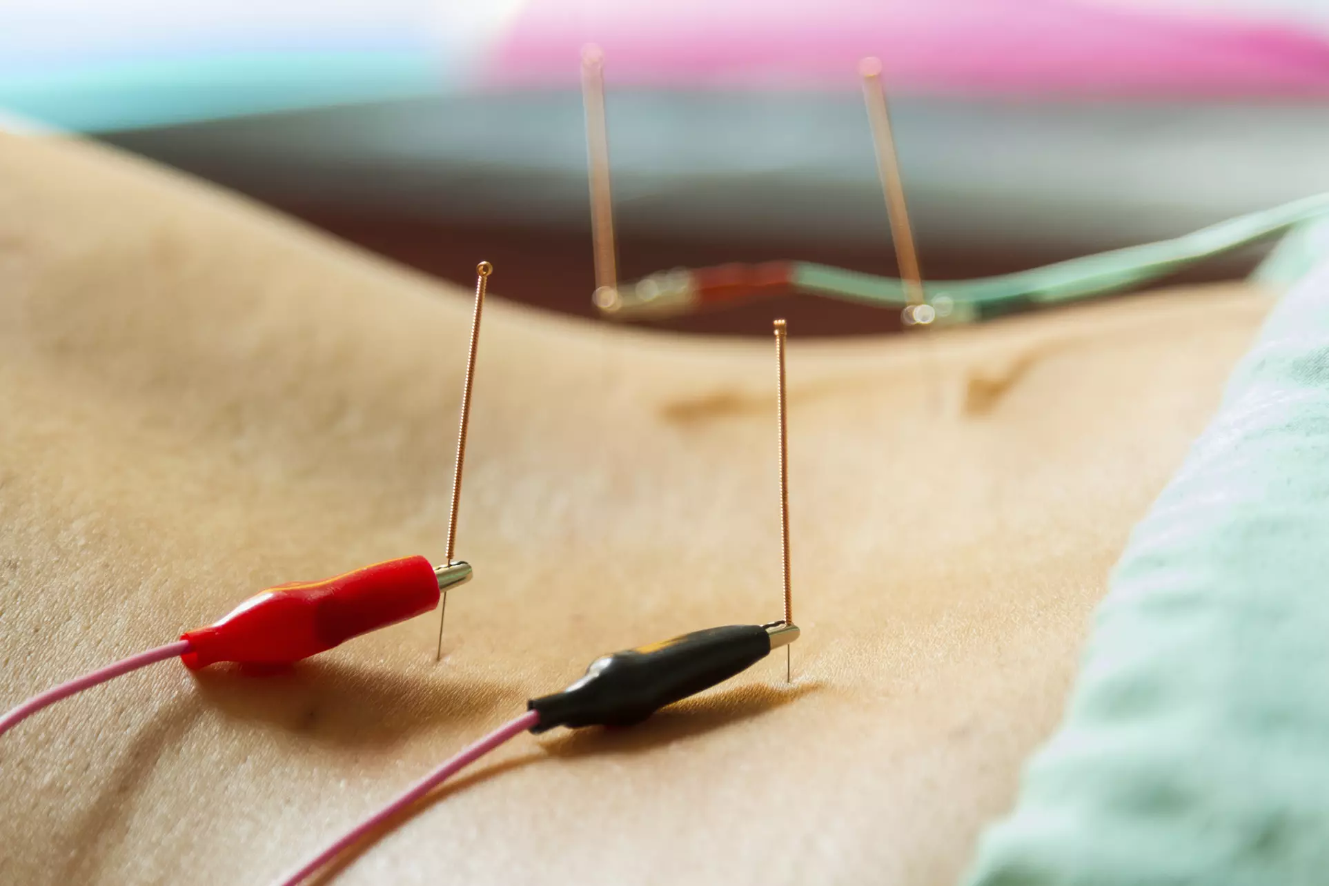 $79 for $165 Worth of Acupuncture — Greenwich Acupuncture Center, Inc. - Primary Image