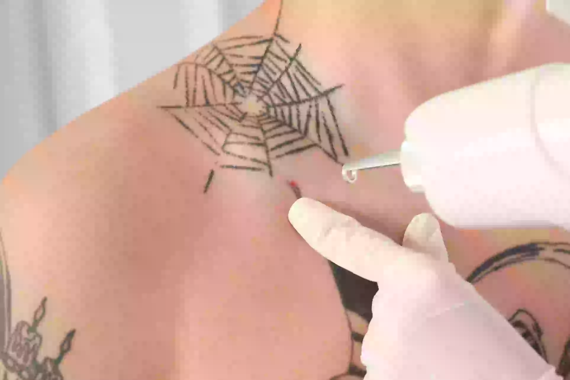 Three or Six Tattoo Removal Sessions at National Laser Institute Medical Spa (Up to 64% Off) - Primary Image