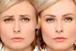 Botox Treatments with Single or Two Sessions, or Botox Plus Restylane at Dr. V's NY Med Spa—Up to 49% Off - Image 3