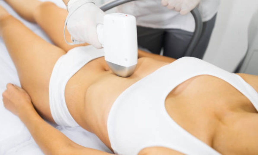 Image 6: Sesiones de depilación láser en zona corporal a elegir