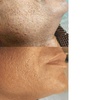 Image 5: 8 Laser Hair Removal Sessions on One Extra Small, Small, Medium & More