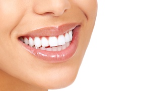 30-Min Teeth Whitening Treatment