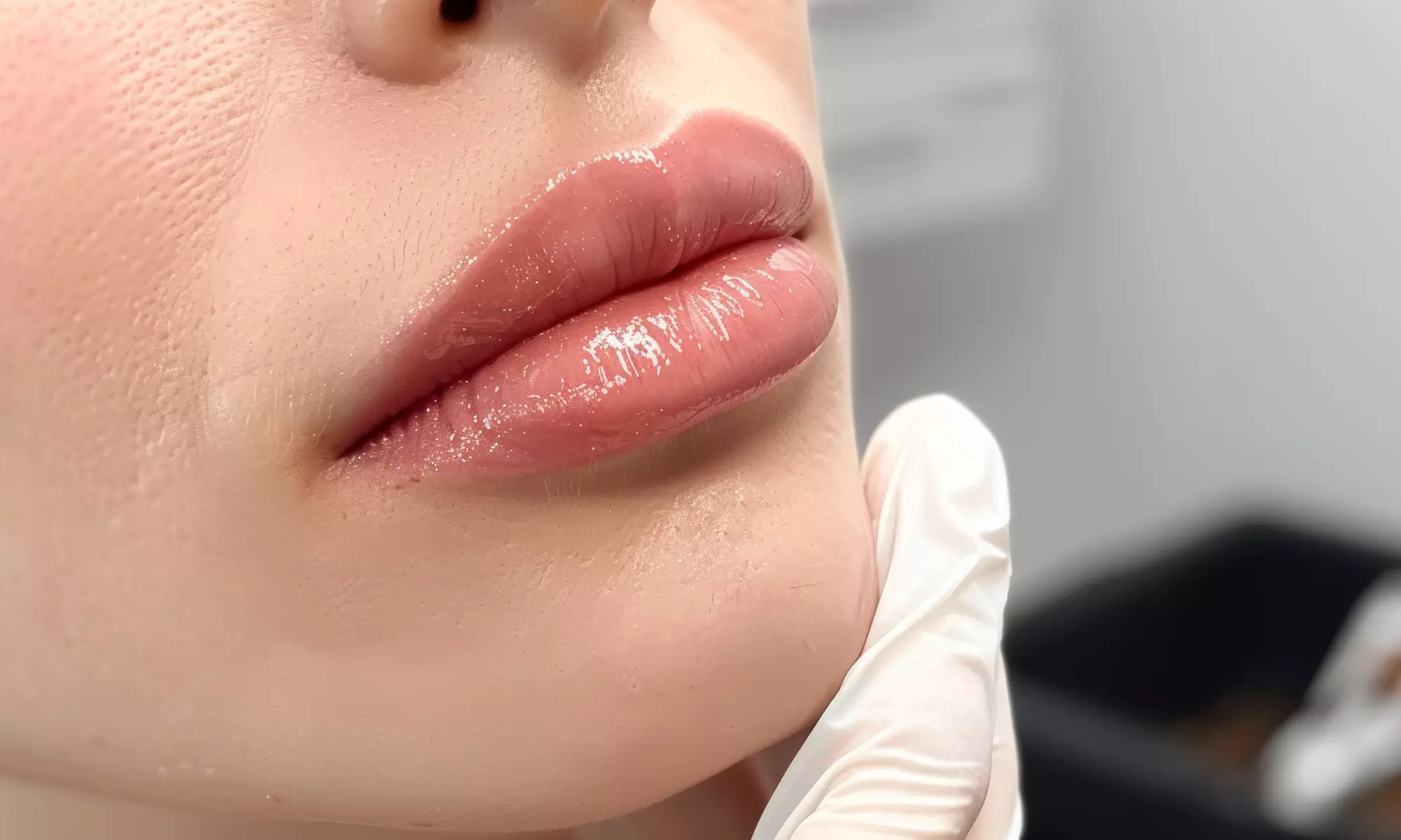 Experience wrinkle smoothing with Jeuveau and Dysport units