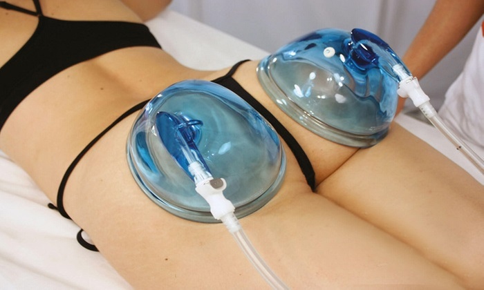 Séances de lifting colombien