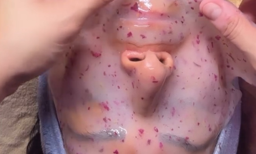 Image 2: 1 or 2 Hydrodermabrasion Facials+Red Light Therapy+Hydrojelly Mask
