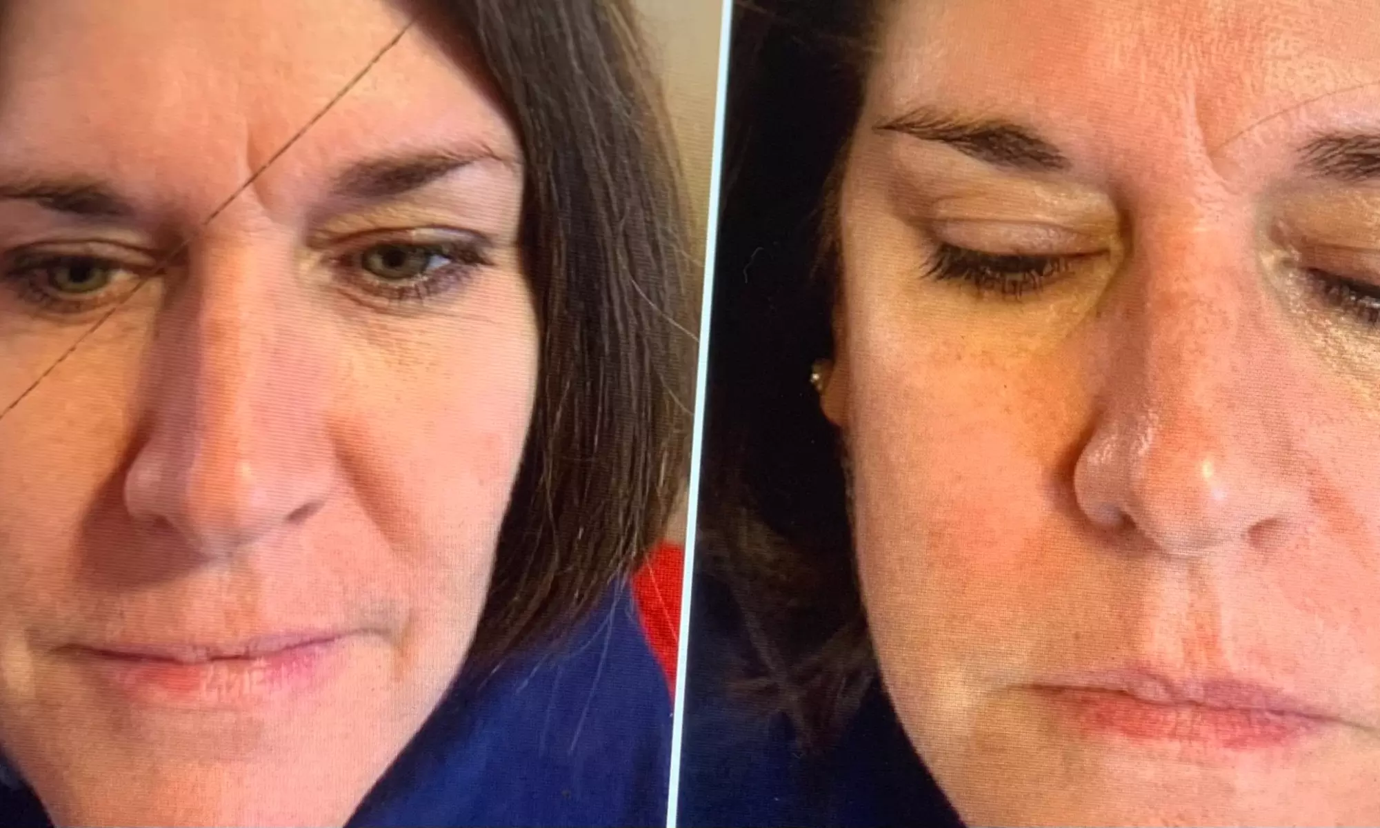 Heavenly Touch by Donna offers radio frequency skin tightening options for a rejuvenated look, up to 30% off - Primary Image