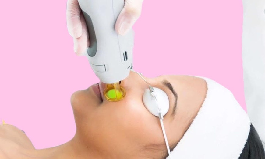 Image 1: Enjoy radiant skin with Beauty Factory Boutique Spa's laser Genesis and HydraFacials options, offering up to 54% off