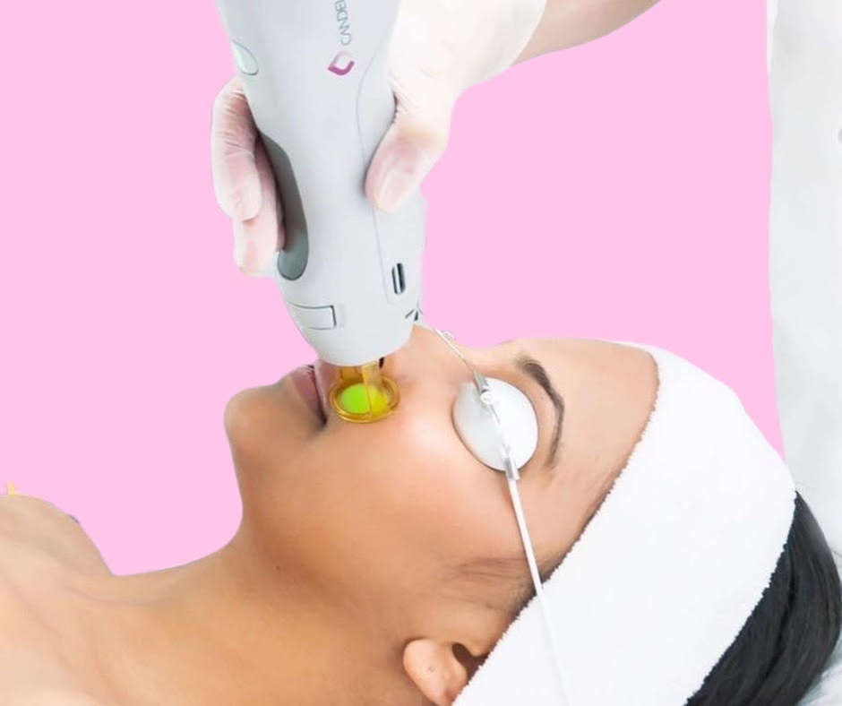 Enjoy radiant skin with Beauty Factory Boutique Spa's laser Genesis and HydraFacials options, offering up to 54% off