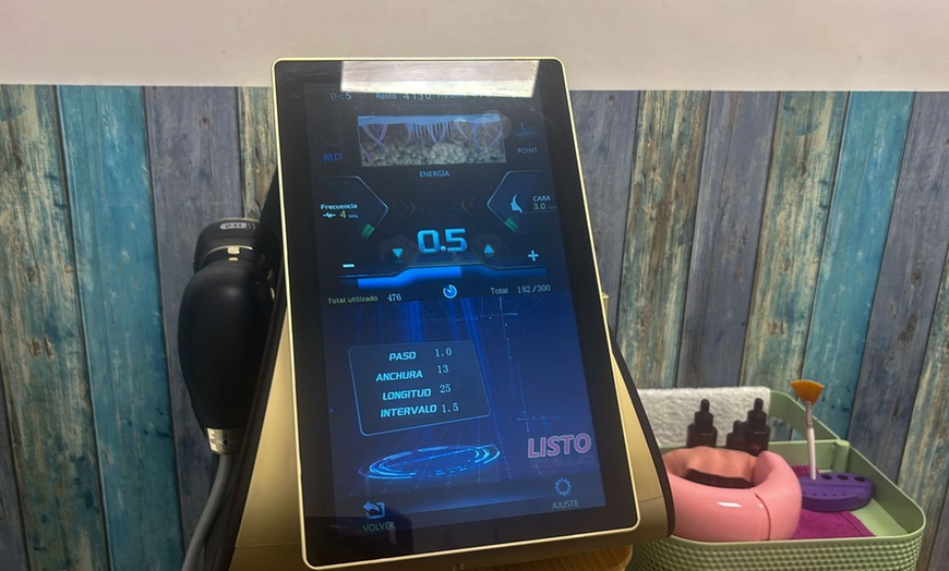 Image 5: 1 o 2 sesiones de HIFU 22D corporal en zona a elegir para 1