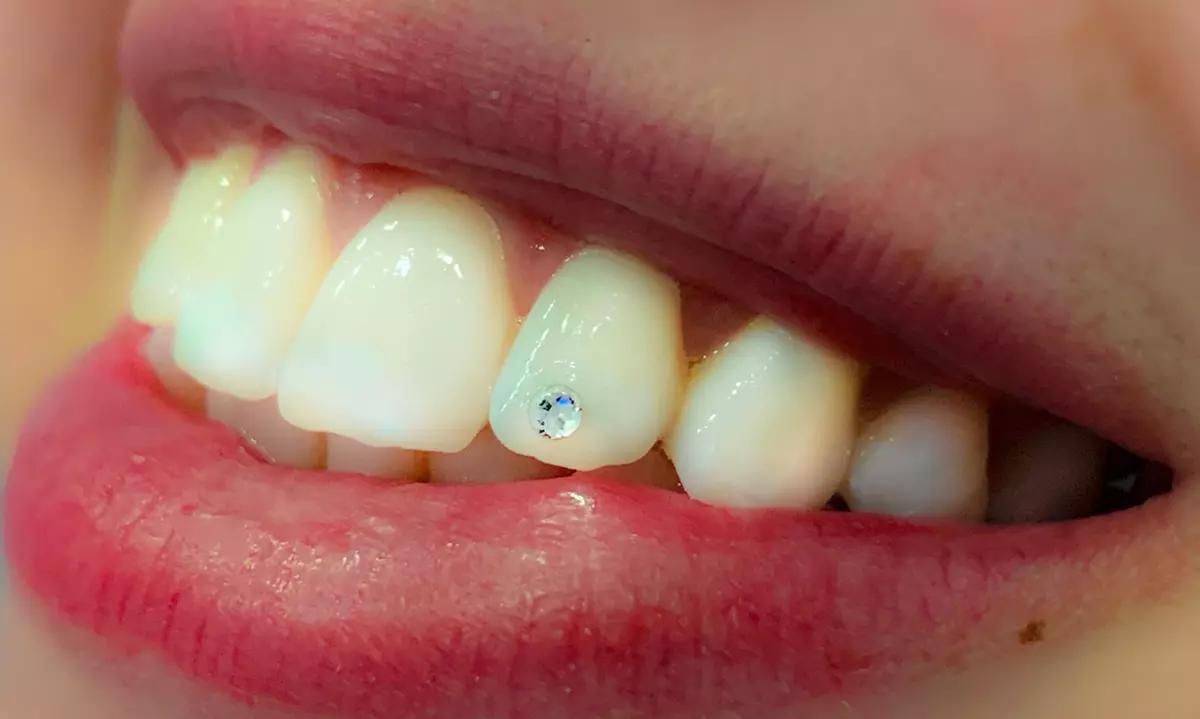 Up to 50% Off at Teeth Whitening by Vegas Brite - Primary Image