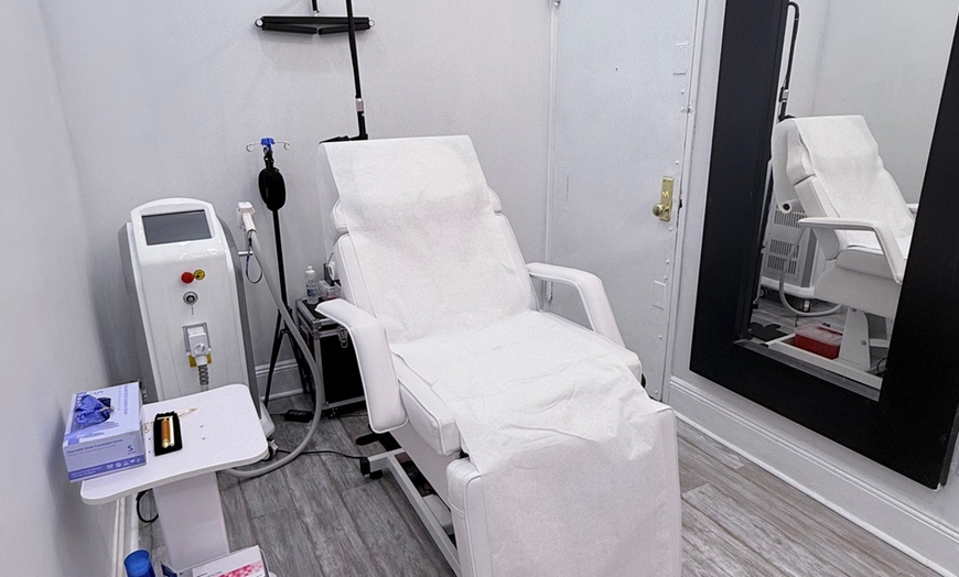 Image 2: Up to 47% Off on Injection - Dermal Filler at Gloday med spa