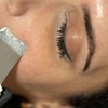 Image 7: 1 o 2 sesiones de limpieza facial con tratamiento a elegir para 1