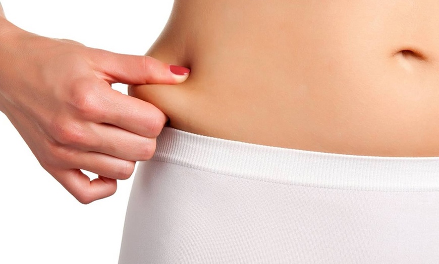 Image 1: Sesiones de cavitación, radiofrecuencia, vacumterapia y drenante