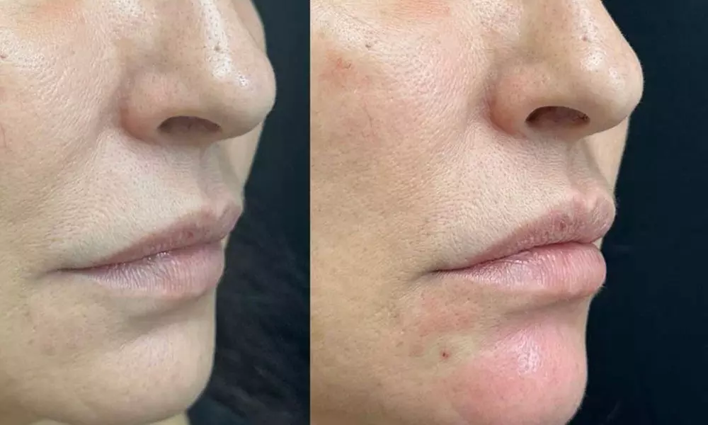Snag a $100 or $200 Gift Card for Cosmetic Services