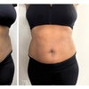 Image 3: 60- or 90-Min Body Contouring for One or Multiple Areas