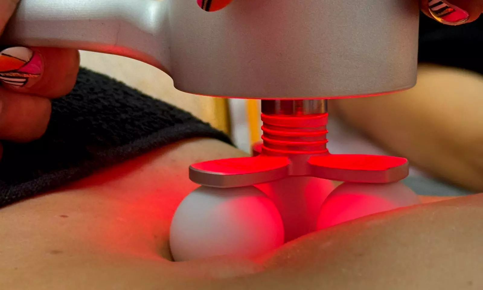 3, 6 o 9 sesiones de tratamiento BellAction Dúo en zona a elegir