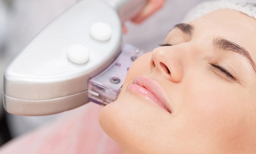 Image 4: Up to 67% Off on Facelift - Non-Surgical at UK Aesthetics Lounge