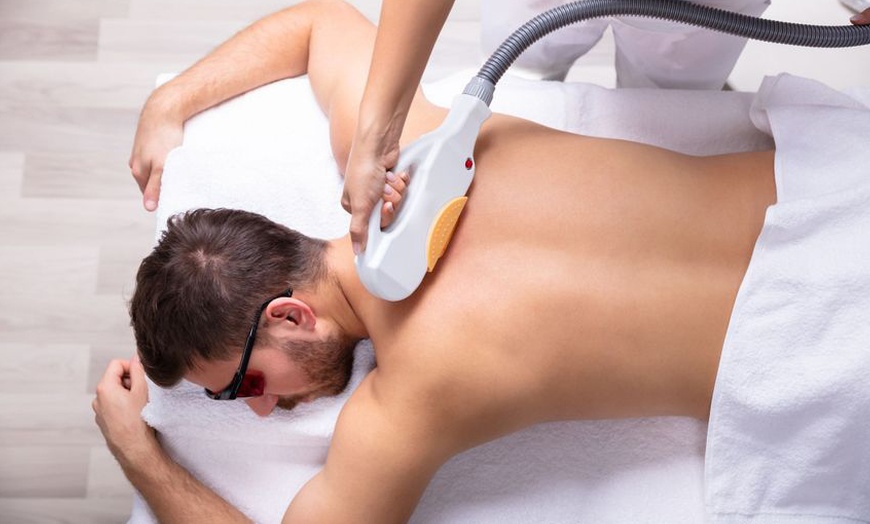 Image 3: Unlimited Laser Hair Removal Sessions For One Year