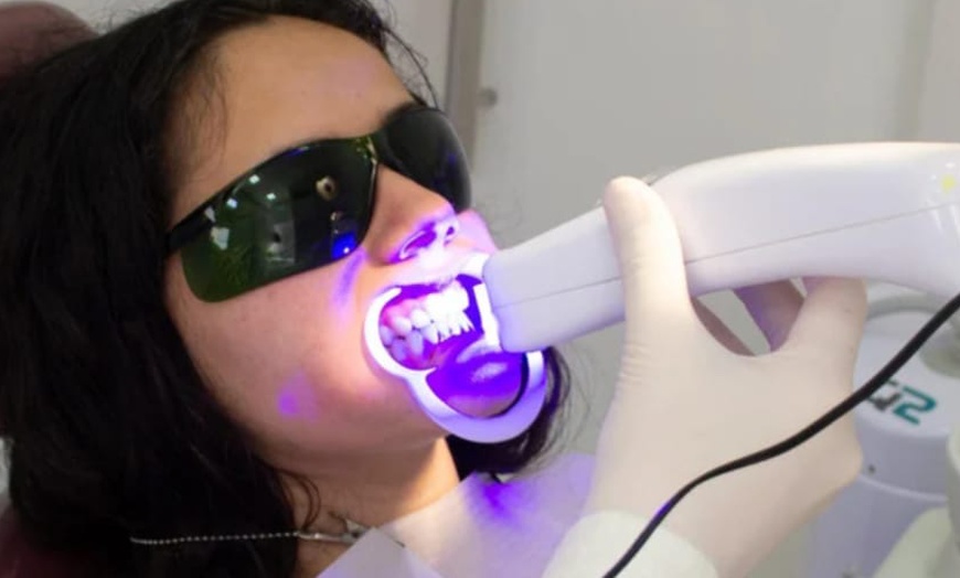 Image 5: Diamant Zahn-Bleaching inkl. 3 Gelanwendungen für 1 Person