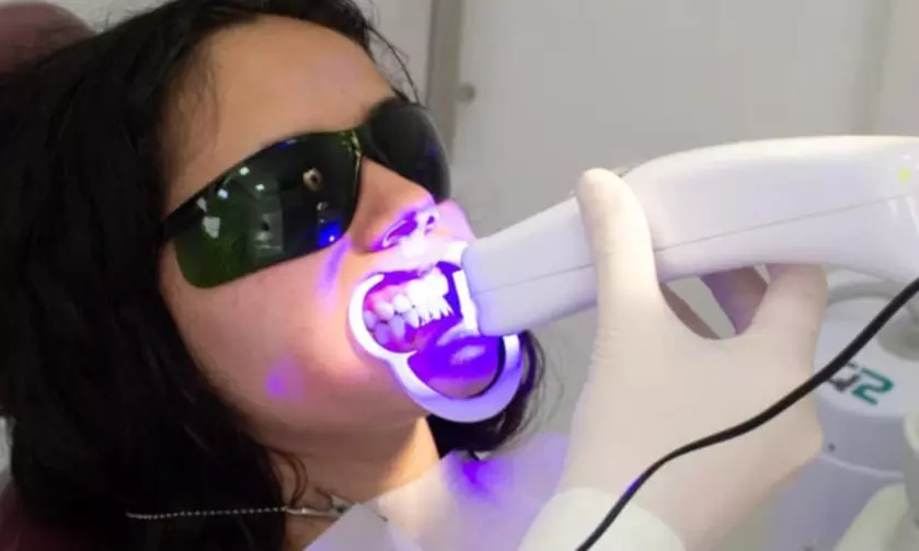 Diamant Zahn-Bleaching inkl. 3 Gelanwendungen für 1 Person