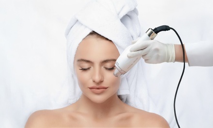 One VAMP Salmon DNA Micro Needling Treatment - Instant Beauty Skin Studio