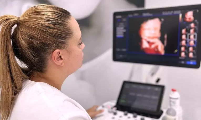 Ecografía 5D: Latido, fotos y vídeos desde la semana 7 con un 25% de descuento - Primary Image