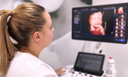 ECO5D (7-13 semanas) : Ecografia + latido +  fotos-video en el movil - EcoBB Gandía