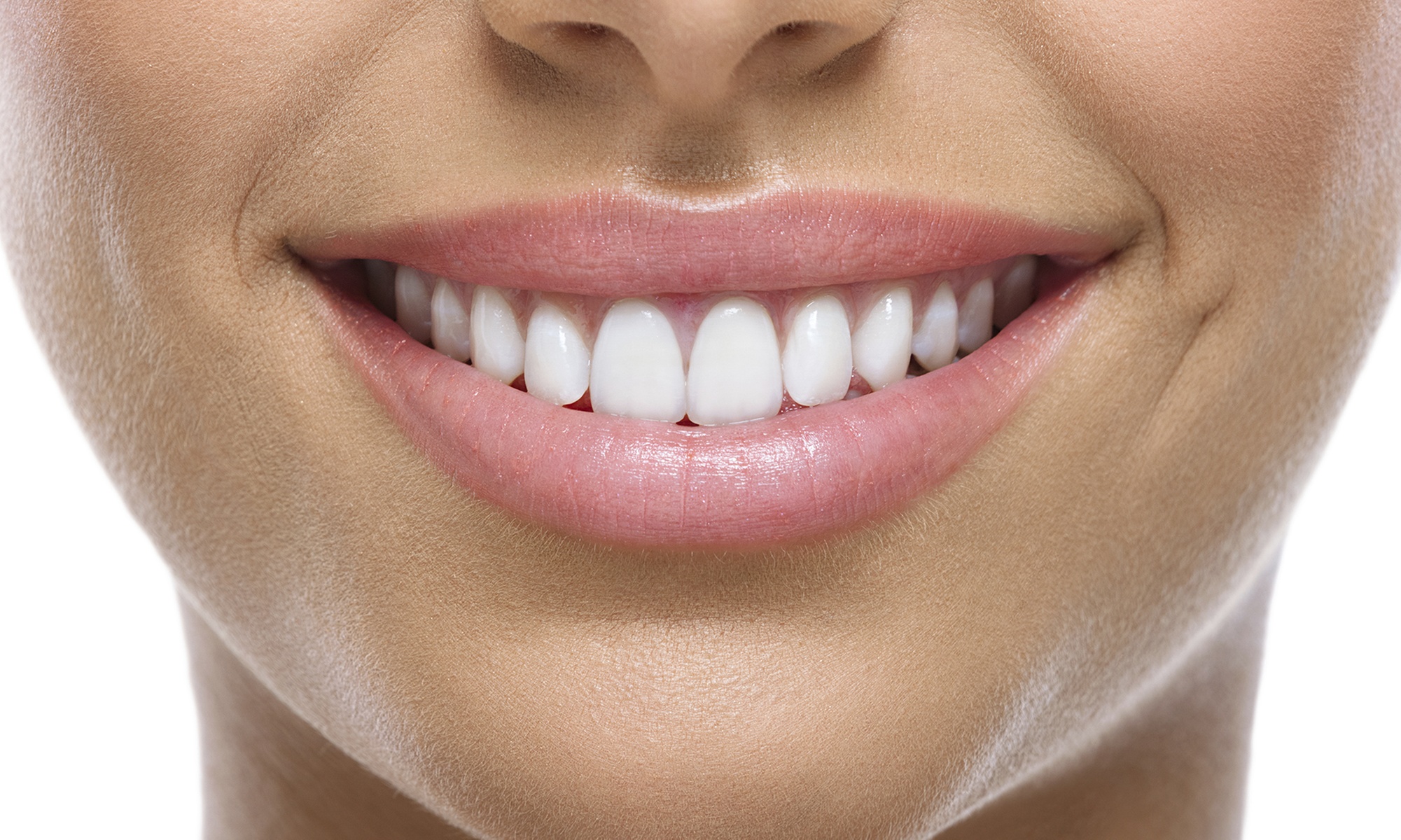 75% Off Teeth Whitening