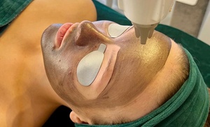 Laserowy peeling węglowy i spersonalizowana maska Laserowy peeling węglowy i spersonalizowana maska