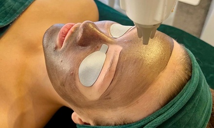 Laserowy peeling węglowy na twarz (45 min)