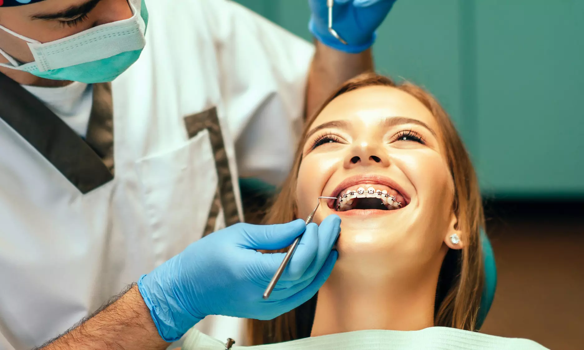 Ortodoncia con brackets metálicos convencionales o autoligados