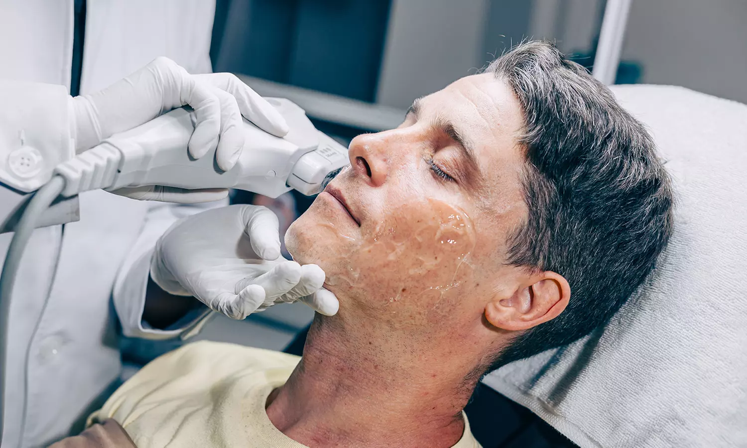 5D Hifu Treatment at Miami Kiss (Up to 82% Off) - Second Medium