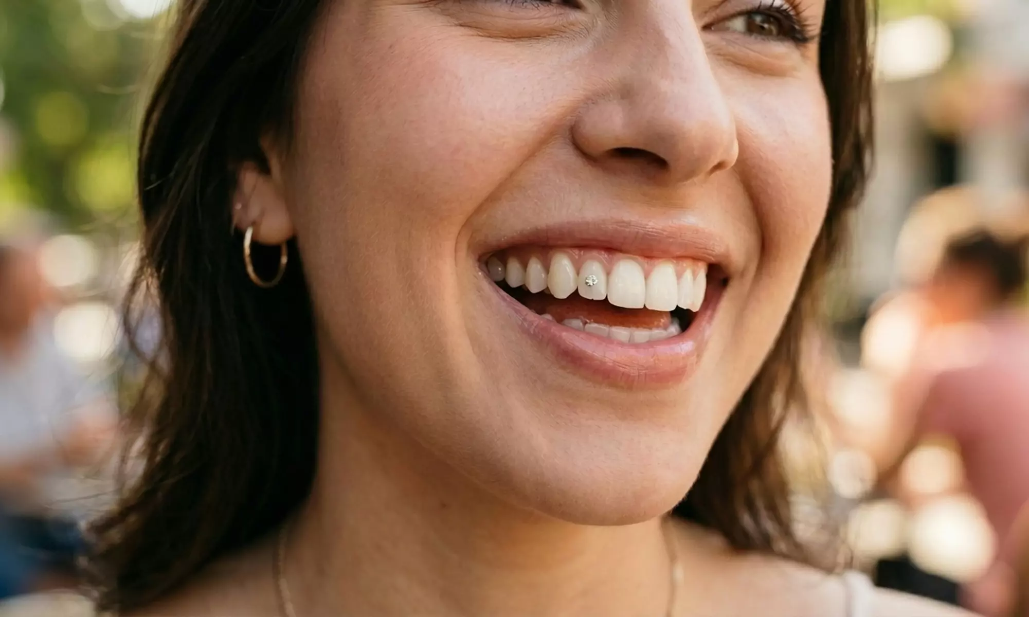 Limpieza bucal con revisión, diagnóstico y colocación de brillante