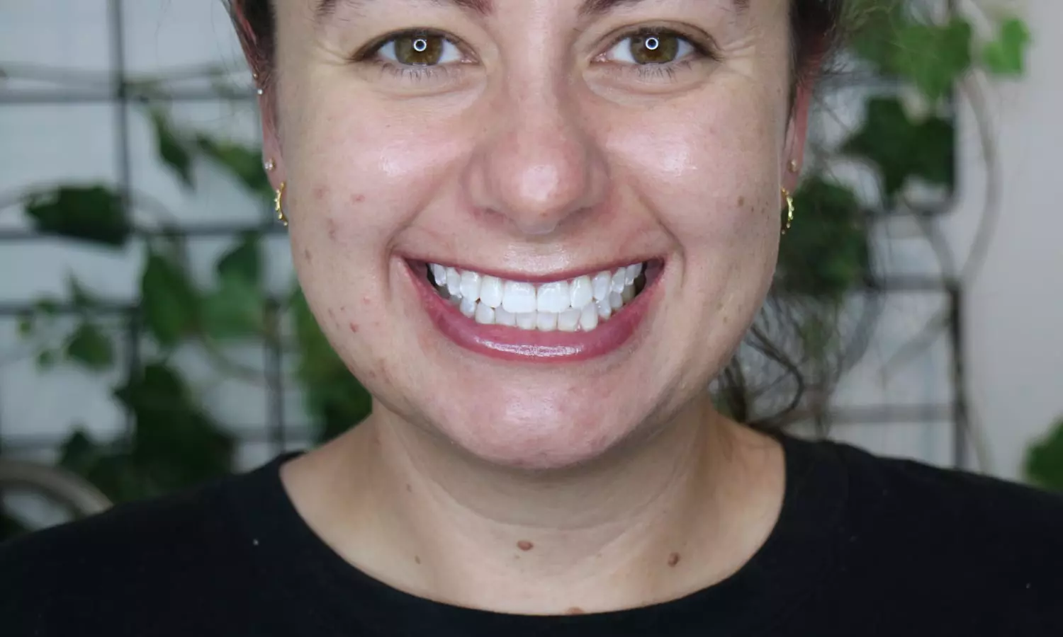 Premium 60-Minute Teeth Whitening (Minimum 8 Shades Lighter)