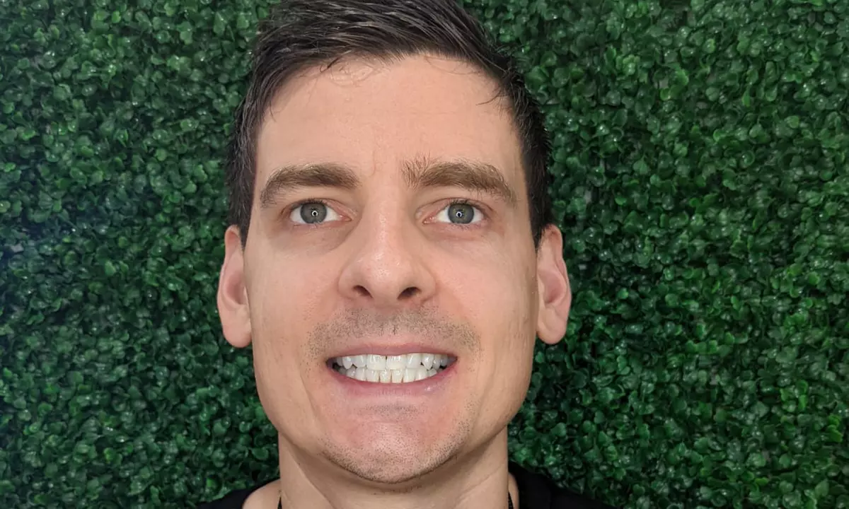 Premium 60-Minute Teeth Whitening at Smile Labs Penrith