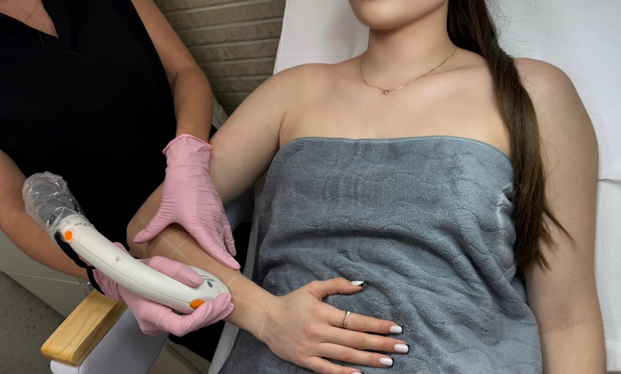 Image 2: Depilacja laserowa: pojedyncze zabiegi lub pakiet roczny