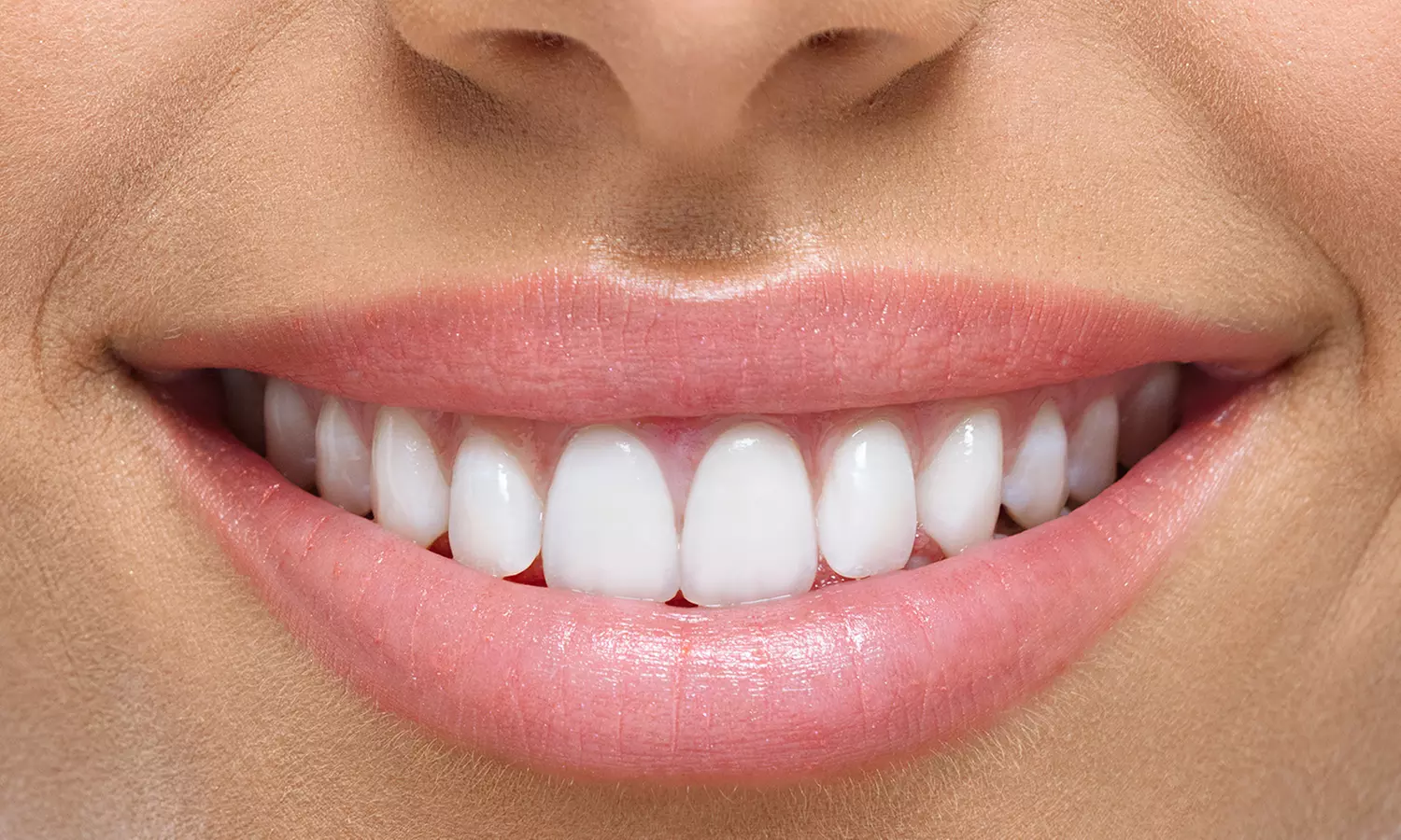 Kosmetisches Zahn-Bleaching