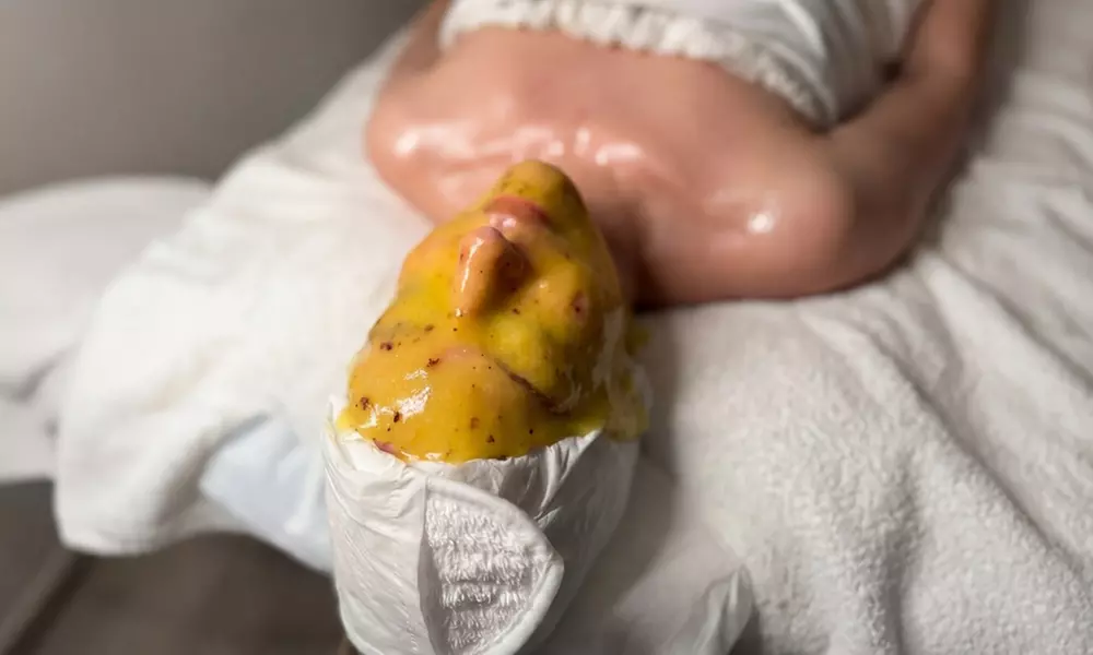 Get One, Two, or Three Full-Face Chemical Peels with Dry Head Spa