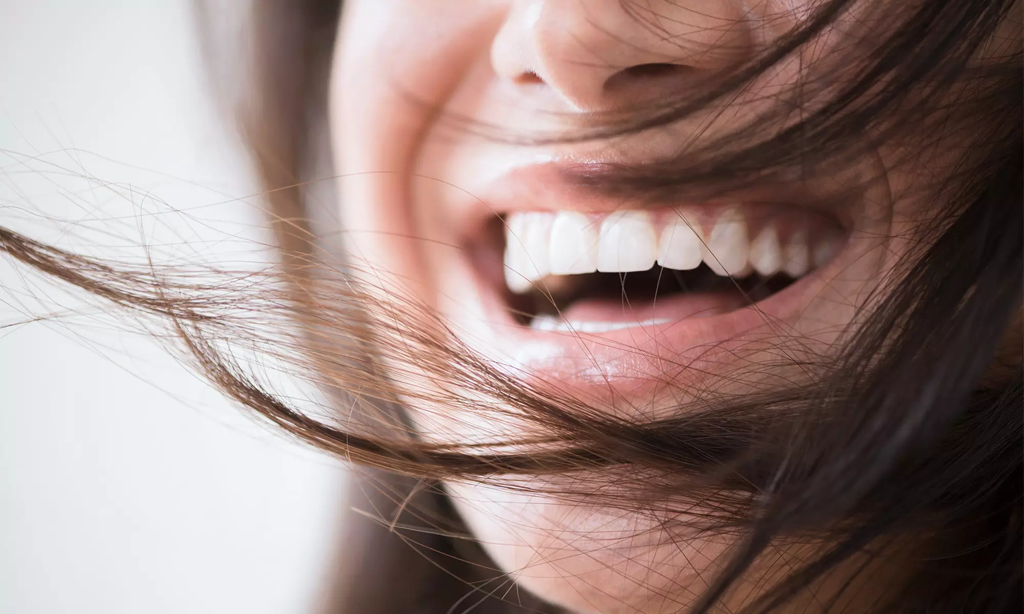 $49 for One BleachBright Teeth Whitening Session at Cryo Myst Therapy Lounge ($79 Value) - Primary Image