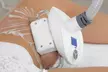 Dites adieu aux graisses localisées avec la cryolipolyse pour cibler les zones rebelles (jusqu'à 77% de remise) - Image 2