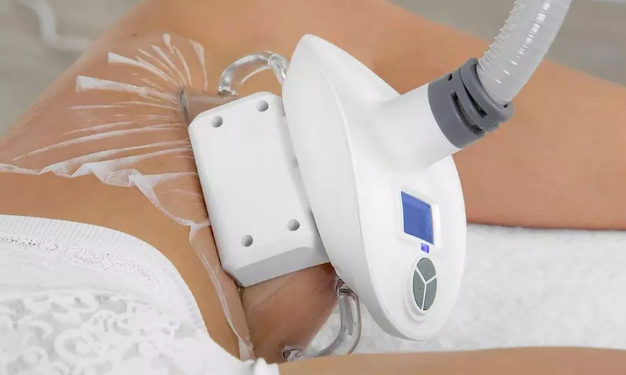 Une silhouette affinée sans chirurgie ? Découvrez la cryolipolyse !