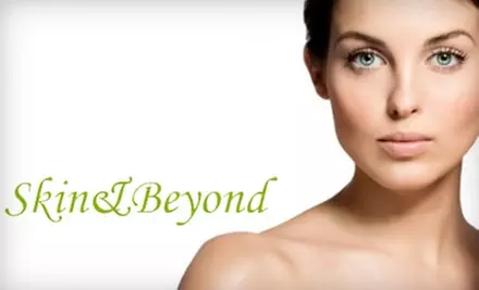 $125 for a Botox Treatment ($200 Value) or an IPL Photofacial ($300 Value) at Skin & Beyond  - Primary Image