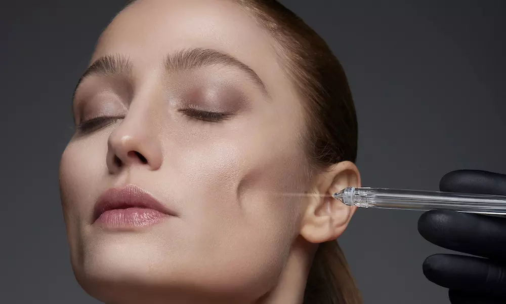 57% Rabatt auf Gesichtsbehandlung – Jet-Peel bei Goldstandard - Primary Image